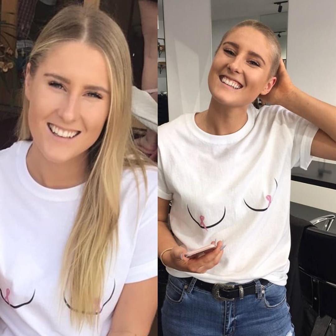 20-short-hairstyle-before-after